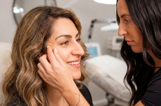 Crows feet – Bella Plastic Surgery Sydney